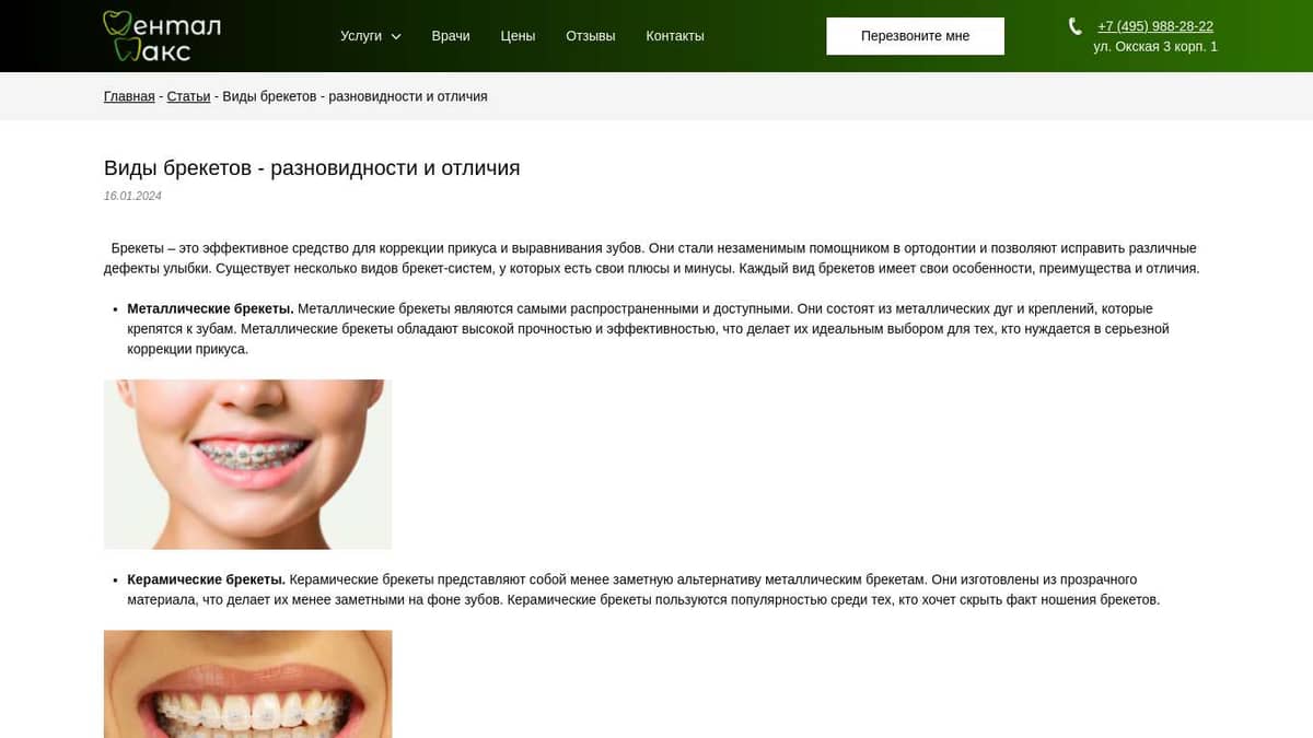 Виды брекетов — разновидности и отличия. Стоматология Дентал Макс в ...